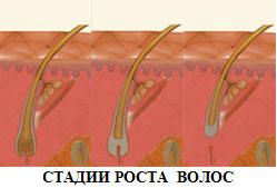 ЭЛОС эпиляция – избавьтесь от волос