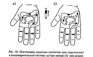 Лечебный массаж су-джок