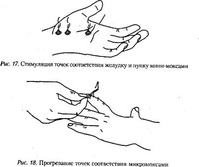 Лечебный массаж су-джок