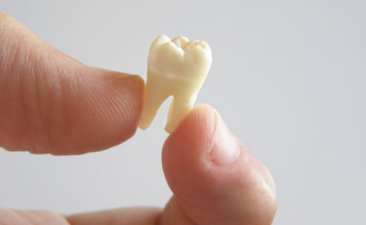 Приснилось что у человека выпал зуб. К чему снится выпадение зубов: сонник