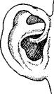форма ушной раковины